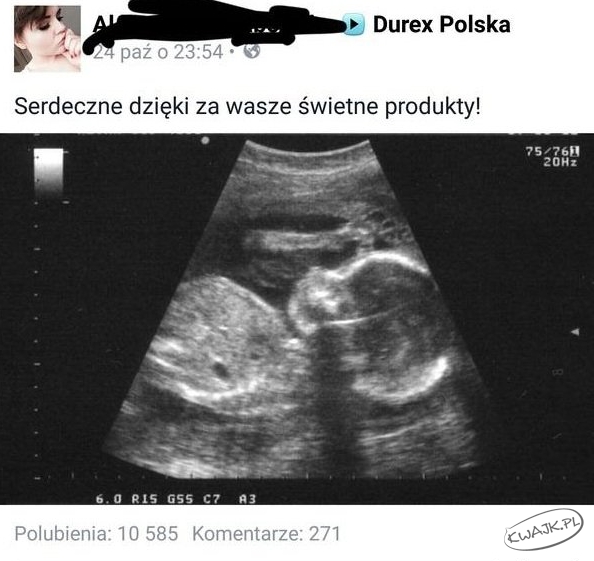 Podziękowanie dla Durex Polska